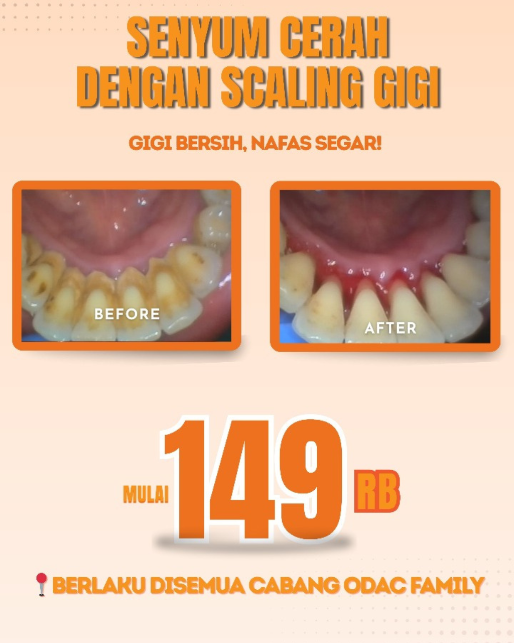 Promo Spesial Scaling di ODAC Family!