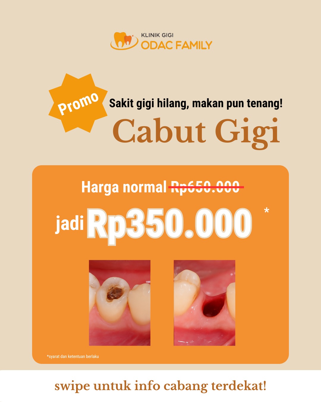 PROMO CABUT GIGI - Mulai dari Rp350.000 aja!