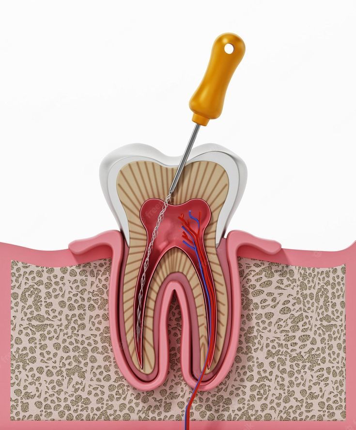 Nerve Treatment